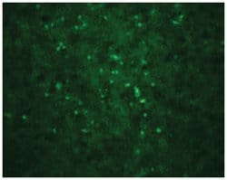 West Nile Virus Core Rabbit anti-Viruses, Polyclonal Antibody, Abnova 100&mu;g;