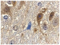 MLST8 (GBL) Rabbit anti-Human, Mouse, Rat, Polyclonal Antibody, Abnova
