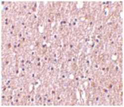 TNFSF12 Rabbit anti-Human, Mouse, Rat, Polyclonal Antibody, Abnova 100&mu;g;