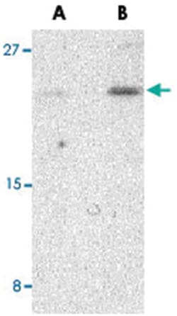 BIK Rabbit anti-Human, Mouse, Polyclonal Antibody, Abnova 100 &mu;g | Buy Online | Abnova Corporation | Fisher Scientific