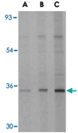 EDA2R, Rabbit, Polyclonal Antibody, Abnova 100&mu;g; Unlabeled:Antibodies,