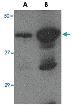 Avian Influenza Hemagglutinin 2, Goat, Polyclonal Antibody, Abnova 100 &mu;g | Buy Online | Abnova Corporation | Fisher Scientific