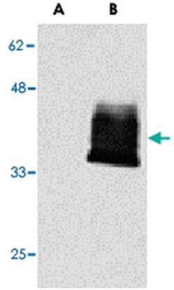 TNFRSF12A Rabbit anti-Human, Polyclonal Antibody, Abnova 100&mu;g; Unlabeled:Antibodies,
