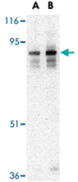 LIPE Rabbit anti-Human, Mouse, Rat, Polyclonal Antibody, Abnova 100&mu;g;