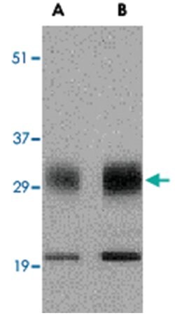 SCO1, Rabbit, Polyclonal Antibody, Abnova 100μg; Unlabeled:Antibodies,