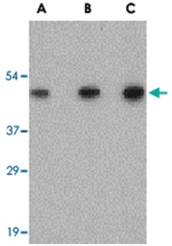 SCO2, Rabbit, Polyclonal Antibody, Abnova 100&mu;g; Unlabeled:Antibodies,