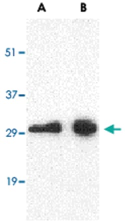 CD274, Rabbit, Polyclonal Antibody, Abnova 100&mu;g; Unlabeled:Antibodies,