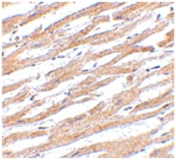 CD274, Rabbit, Polyclonal Antibody, Abnova 100&mu;g; Unlabeled:Antibodies,