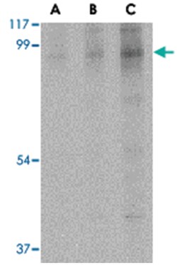 BRSK2, Rabbit, Polyclonal Antibody, Abnova 100&mu;g; Unlabeled:Anticuerpos