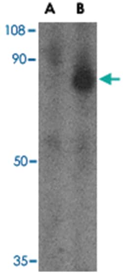 FEZ1, Rabbit, Polyclonal Antibody, Abnova 100 &mu;g | Buy Online | Abnova Corporation | Fisher Scientific