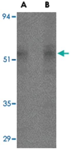 STEAP4 Rabbit anti-Human, Mouse, Rat, Polyclonal Antibody, Abnova 100&mu;g;