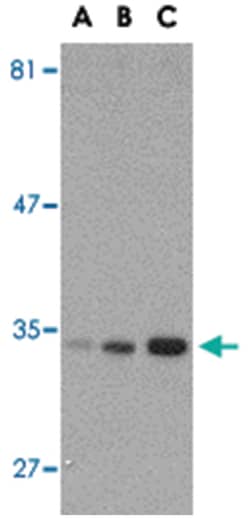 ATG10 Rabbit anti-Human, Mouse, Rat, Polyclonal Antibody, Abnova 100&mu;g;
