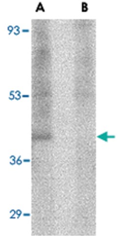 RIMS3, Rabbit, Polyclonal Antibody, Abnova 100 &mu;g | Buy Online | Abnova | Fisher Scientific