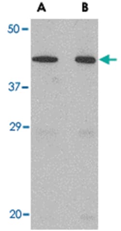 NPTX2 Rabbit anti-Human, Mouse, Rat, Polyclonal Antibody, Abnova 100&mu;g;