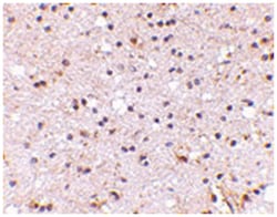 NPTX2 Rabbit anti-Human, Mouse, Rat, Polyclonal Antibody, Abnova 100&mu;g;