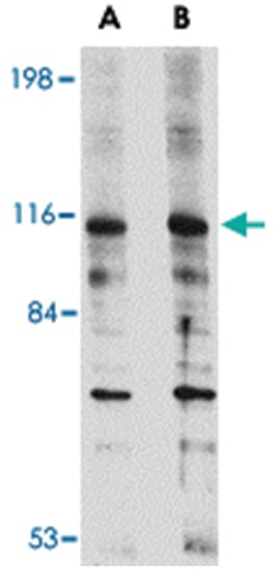 DLGAP2, Rabbit, Polyclonal Antibody, Abnova 100&mu;g; Unlabeled:Antibodies,
