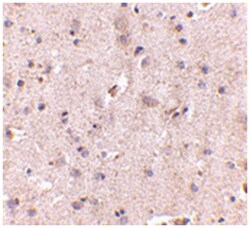 DLGAP2, Rabbit, Polyclonal Antibody, Abnova 100&mu;g; Unlabeled:Antibodies,