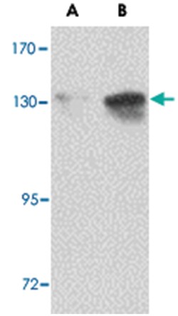 NUP155 Rabbit anti-Human, Mouse, Polyclonal Antibody, Abnova 100 &mu;g | Buy Online | Abnova | Fisher Scientific