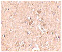MED28 Rabbit anti-Human, Mouse, Polyclonal Antibody, Abnova 100&mu;g; Unlabeled:Antibodies,