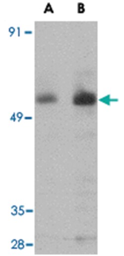 PARL, Rabbit, Polyclonal Antibody, Abnova 100&mu;g; Unlabeled:Antibodies,