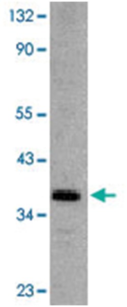 Dffb Rabbit anti-Mouse, Rat, Polyclonal Antibody, Abnova 100&mu;g; Unlabeled:Antibodies,