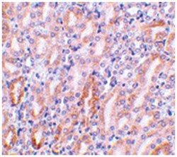Dffb Rabbit anti-Mouse, Polyclonal Antibody, Abnova 100&mu;g; Unlabeled:Antibodies,