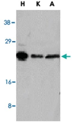 NOL3 Rabbit anti-Human, Polyclonal Antibody, Abnova 100&mu;g; Unlabeled:Antibodies,