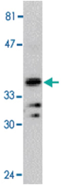 MYD88 Rabbit anti-Human, Polyclonal Antibody, Abnova 100&mu;g; Unlabeled:Antibodies,