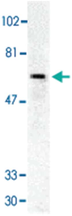 TNFRSF10C Rabbit anti-Human, Mouse, Rat, Polyclonal Antibody, Abnova 100&mu;g;