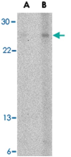 TNFSF13 Rabbit anti-Human, Polyclonal Antibody, Abnova 100&mu;g; Unlabeled:Antibodies,