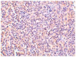 IL27RA Rabbit anti-Human, Polyclonal Antibody, Abnova 100&mu;g; Unlabeled:Antibodies,