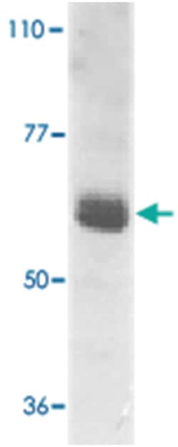 IL22RA1 Rabbit anti-Human, Rat, Polyclonal Antibody, Abnova 100&mu;g; Unlabeled:Antibodies,