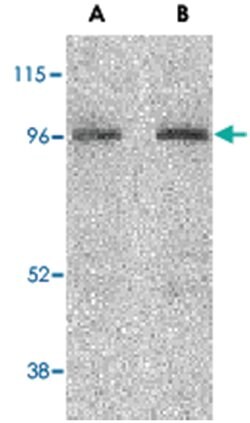 NOD2 Rabbit anti-Human, Polyclonal Antibody, Abnova 100&mu;g; Unlabeled:Antibodies,