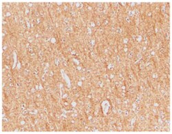 ANTXR1 Rabbit anti-Human, Mouse, Rat, Polyclonal Antibody, Abnova 100&mu;g;