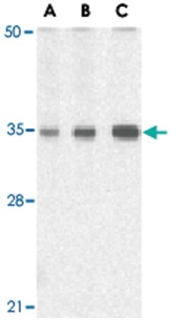 TIRAP Rabbit anti-Human, Mouse, Rat, Polyclonal Antibody, Abnova 100&mu;g;