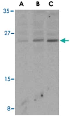 BCL2 Rabbit anti-Human, Mouse, Polyclonal Antibody, Abnova 100&mu;g; Unlabeled:Antibodies,