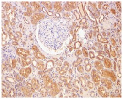 BCL2 Rabbit anti-Human, Mouse, Polyclonal Antibody, Abnova 100&mu;g; Unlabeled:Antibodies,