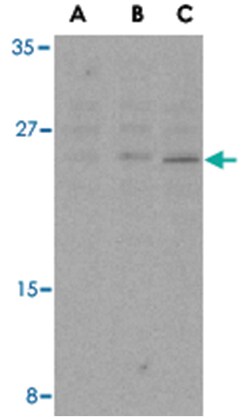 BCL2 Rabbit anti-Human, Polyclonal Antibody, Abnova 100 &mu;g | Buy Online | Abnova | Fisher Scientific