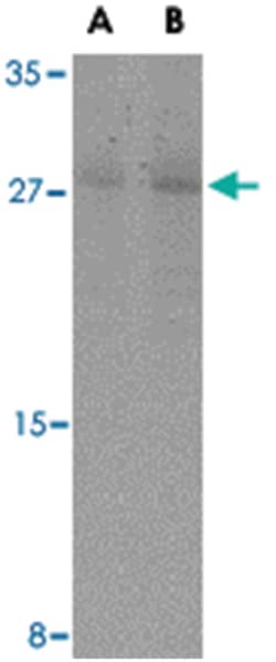 CASP7 Rabbit anti-Human, Mouse, Rat, Polyclonal Antibody, Abnova 100&mu;g;