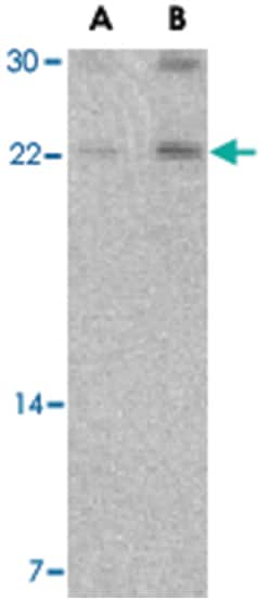 CBLN1, Rabbit, Polyclonal Antibody, Abnova 100&mu;g; Unlabeled:Antibodies,
