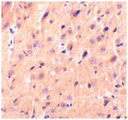 CBLN1, Rabbit, Polyclonal Antibody, Abnova 100&mu;g; Unlabeled:Antibodies,