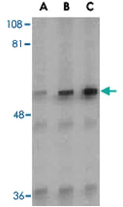 IRAK2 Rabbit anti-Mouse, Polyclonal Antibody, Abnova 100&mu;g; Unlabeled:Antibodies,