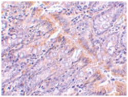 GOPC Rabbit anti-Human, Mouse, Polyclonal Antibody, Abnova 100 &mu;g | Buy Online | Abnova Corporation | Fisher Scientific