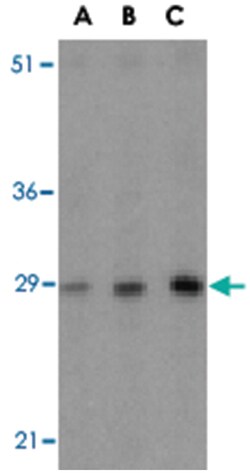 BCAP31 Rabbit anti-Human, Mouse, Rat, Polyclonal Antibody, Abnova 100 &mu;g | Buy Online | Abnova | Fisher Scientific