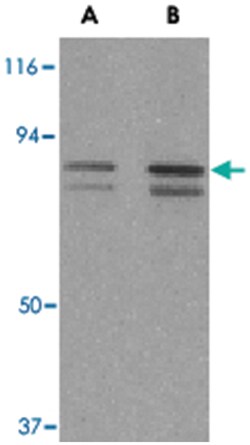 ATF6 Rabbit anti-Human, Mouse, Polyclonal Antibody, Abnova 100 &mu;g | Buy Online | Abnova Corporation | Fisher Scientific