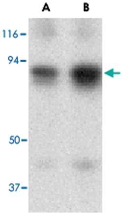 ATF6 Rabbit anti-Human, Mouse, Polyclonal Antibody, Abnova 100&mu;g; Unlabeled:Anticuerpos