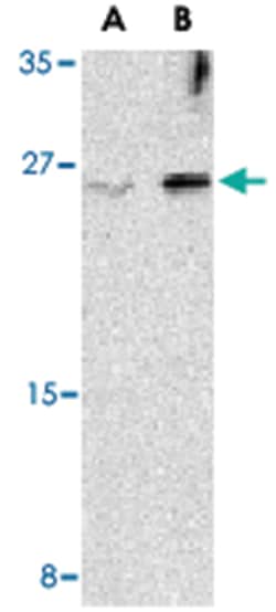 IL32 Rabbit anti-Human, Mouse, Polyclonal Antibody, Abnova 100&mu;g; Unlabeled:Antibodies,