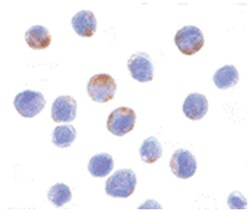 DDX3X Rabbit anti-Human, Mouse, Polyclonal Antibody, Abnova 100&mu;g; Unlabeled:Antibodies,