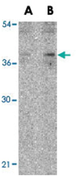 IL27 Rabbit anti-Human, Mouse, Polyclonal Antibody, Abnova 100&mu;g; Unlabeled:Antibodies,