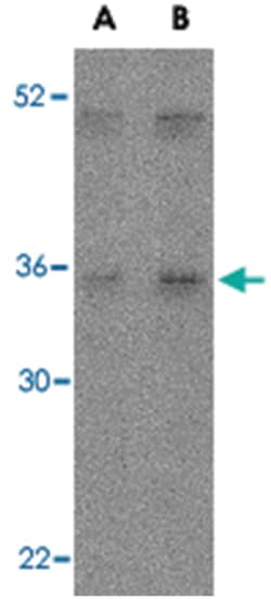 IL27 Rabbit anti-Human, Mouse, Polyclonal Antibody, Abnova 100&mu;g; Unlabeled:Antibodies,